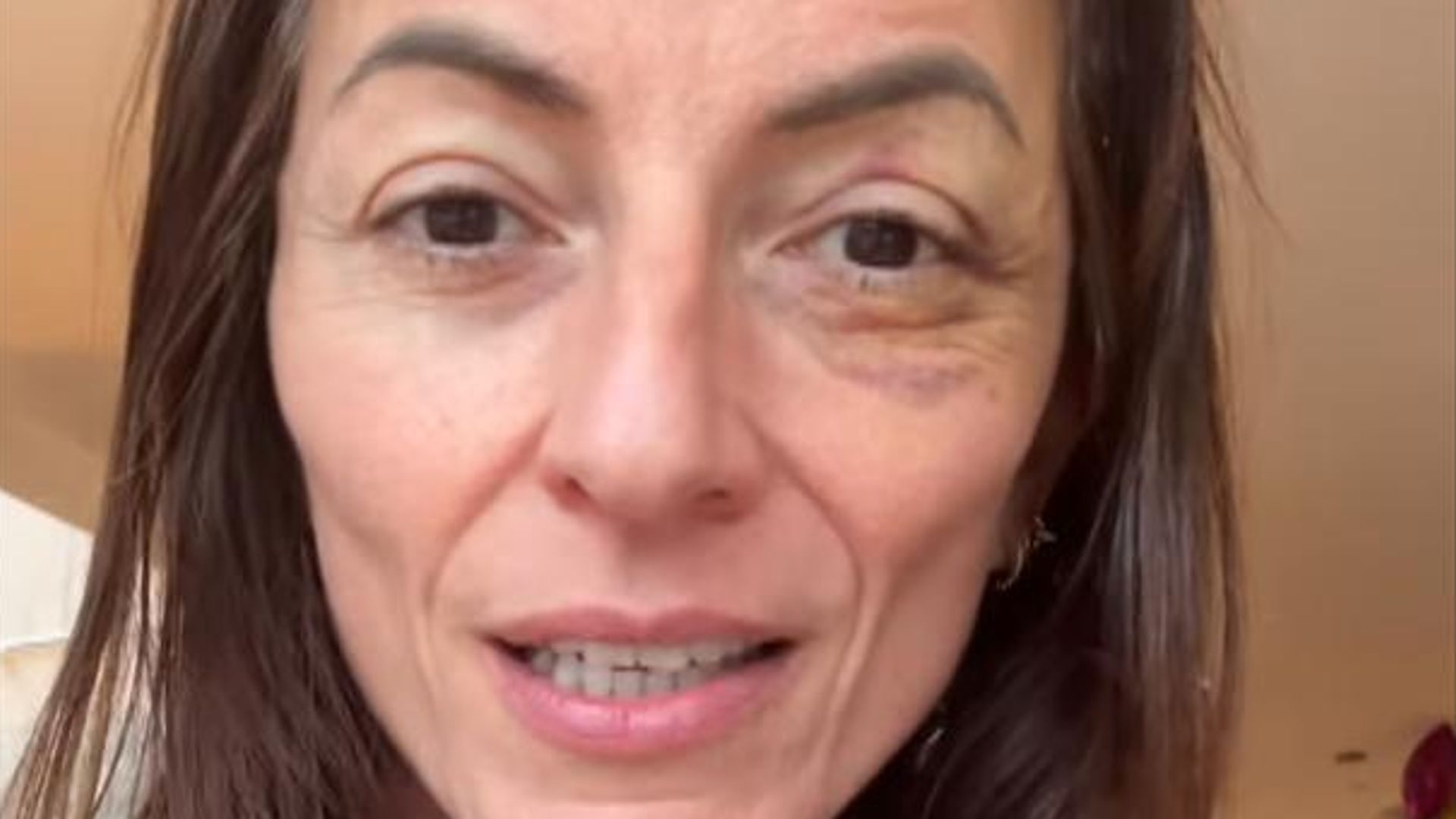 Davina McCall feeling 'stronger and stronger' after brain tumour surgery