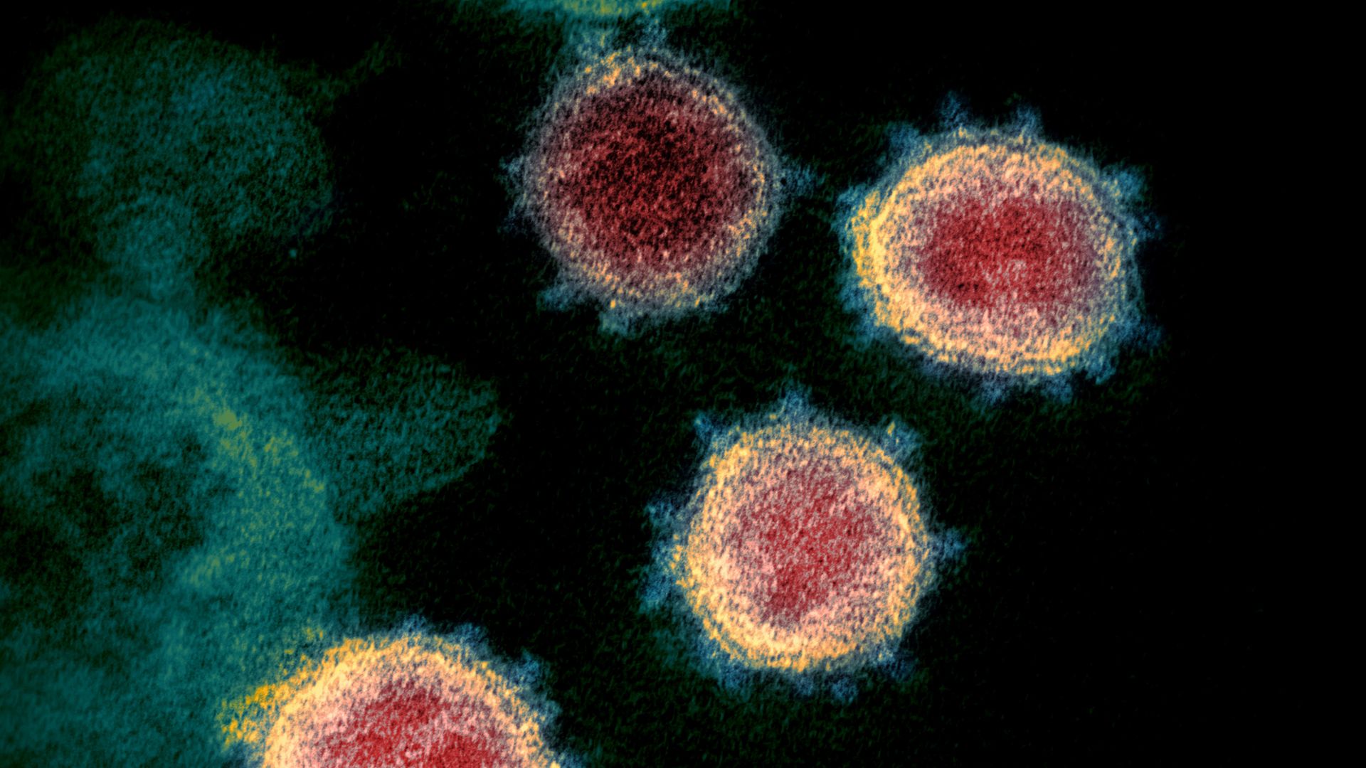 List of viruses and bacteria that pose greatest threat to public health published
